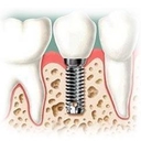 Dr. Jorge Duran Dehesa diplomado en ortodoncia y ortopedia maxilar, diplomado en estetica dental, diplomado en implantes, diplomado en endodoncia