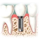 Dr. Jorge Duran Dehesa diplomado en ortodoncia y ortopedia maxilar, diplomado en estetica dental, diplomado en implantes, diplomado en endodoncia