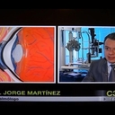 Dr. Jorge Alberto Martínez Mendoza Oftalmología Especialista en Trasplante Corneal y Cirugía Refractiva