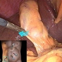 Dr. Cabral Endoscopia Cirugia General, Gastroenterologia y Endoscopia Digestiva.